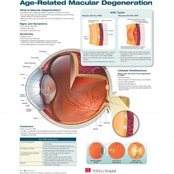 Degeneración macular relacionada con la edad