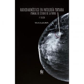 RADIODIAGNOSTICO EN PATOLOGIA MAMARIA-4 ED
