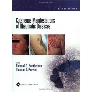 Cutaneous Manifestations of Rheumatic Diseases