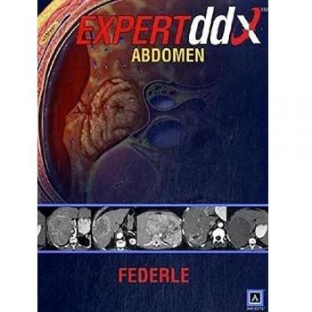 EXPERTddx: Abdomen: Published by Amirsys