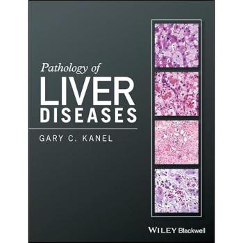 Liver Disease Pathology Comprehensive Guide