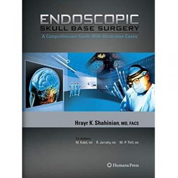 Endoscopic Skull Base Surgery: Comprehensive Guide by Hrayr K. Shahinian