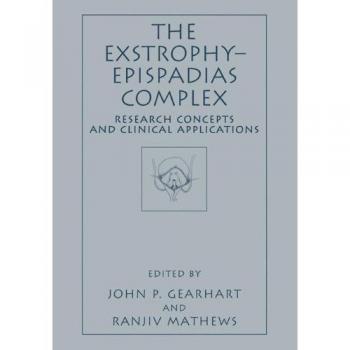 Exstrophy-Epispadias Complex: Research Insights and Clinical Applications