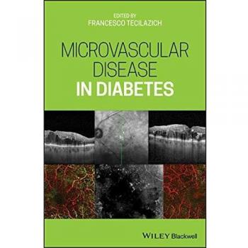 Microvascular Disease in Diabetes