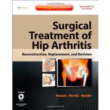 Surgical Treatment of Hip Arthritis: Reconstruction, Replacement, and Revision: Expert Consult - Online