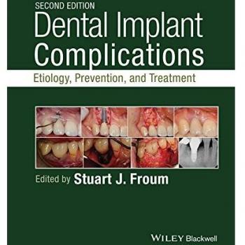 Dental Implant Complications: Etiology, Prevention, and Treatment