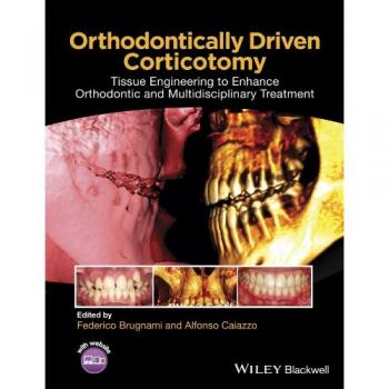 Orthodontic Corticotomy Guide: Tissue Engineering for Enhanced Multidisciplinary Treatment (Hardback)