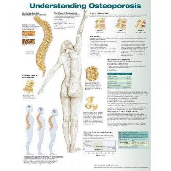 Comprender la osteoporosis