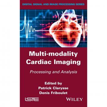 Multi-Modality Cardiac Imaging: Processing and Analysis