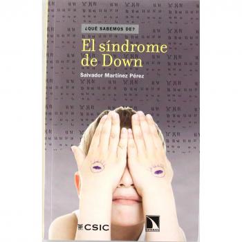 El síndrome de Down