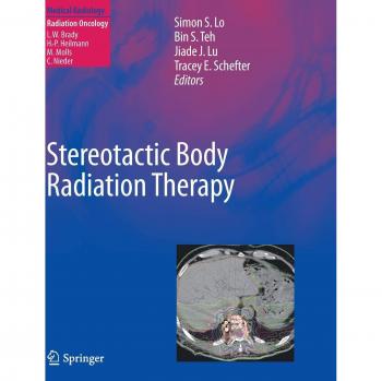 Precision Stereotactic Body Radiation Therapy System