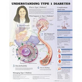 Understanding - Diabetes tipo 1