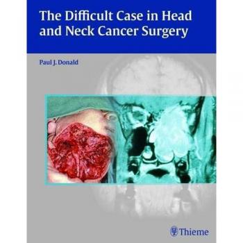 The Difficult Case in Head and Neck Cancer Surgery