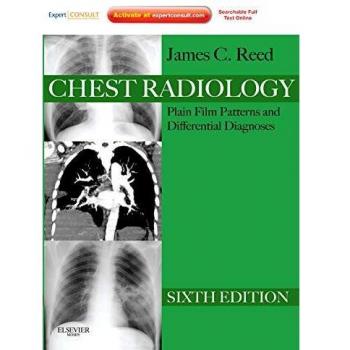 Chest Radiology: Plain Film Patterns and Differential Diagnoses, Expert Consult - Online and Print, 6e