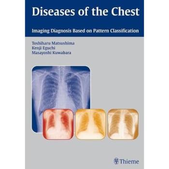 Diseases of the Chest: Imaging Diagnosis Based on Pattern Classification