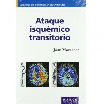 Ataque isquémico transitorio: 0