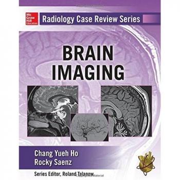 Radiology Case Review Series: Brain Imaging Insights