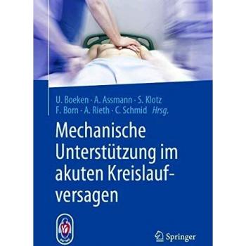 Mechanische Unterstützung im akuten Kreislaufversagen