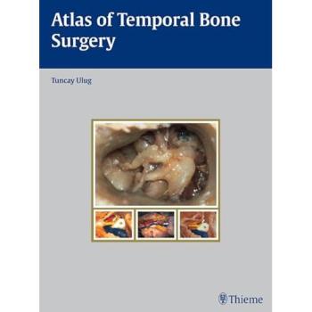 Atlas of Temporal Bone Surgery