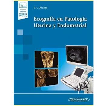 Ecografia en patologia uterina y endometrial