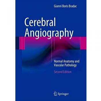 Cerebral Angiography: Normal Anatomy and Vascular Pathology