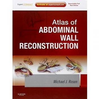 Atlas of Abdominal Wall Reconstruction: Expert Consult - Online and Print, 1e