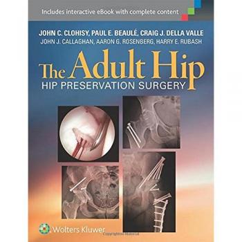 Adult Hip Preservation Surgery Guide