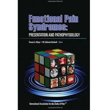Functional Pain Syndromes: Presentation and Pathophysiology