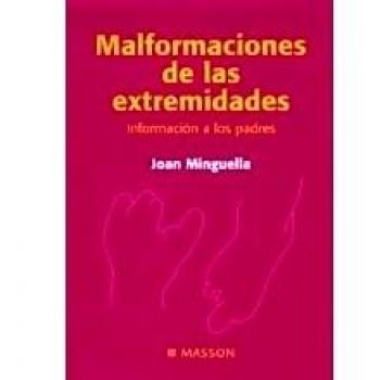 Malformaciones de las extremidades