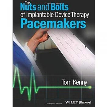 The Nuts and Bolts of Implantable Device Therapy -Pacemakers