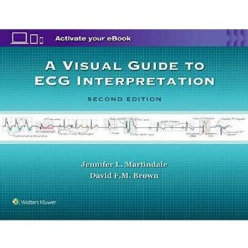 Visual ECG Interpretation Guide: Comprehensive Illustrated Manual for Cardiac Rhythm Analysis