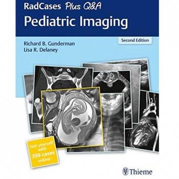 RadCases Plus Q&A: Pediatric Imaging, 2nd Edition - Comprehensive Guide for Pediatric Radiology