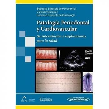 Patologia periodontal y cardiovascular: Patología Periodontal y Cardiovascular