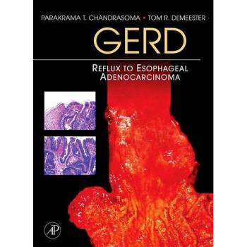 GERD: Reflux to Esophageal Adenocarcinoma