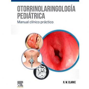 Otorrinolaringología pediátrica