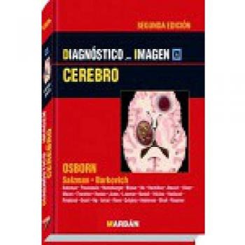 Cerebro