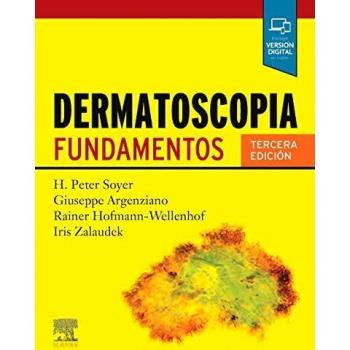 Dermatoscopia: Fundamentos