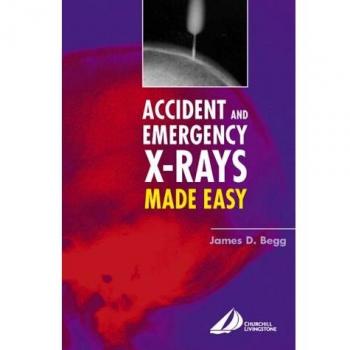 Accident and Emergency X-Rays Made Easy, 1e