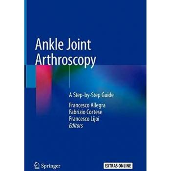 Ankle Joint Arthroscopy: A Step-by-Step Guide