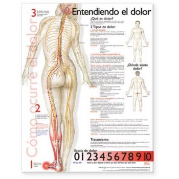 Comprender el gráfico anatómico del dolor en español