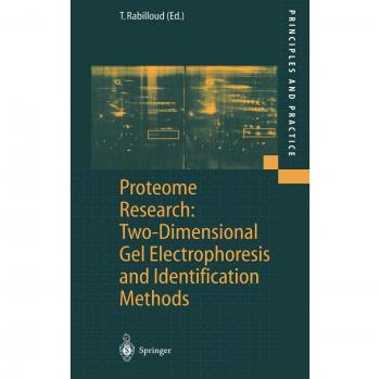 Proteome Research: Two-Dimensional Gel Electrophoresis and Identification Techniques