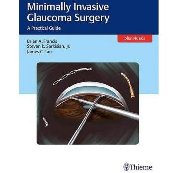 Minimally Invasive Glaucoma Surgery: A Practical Guide