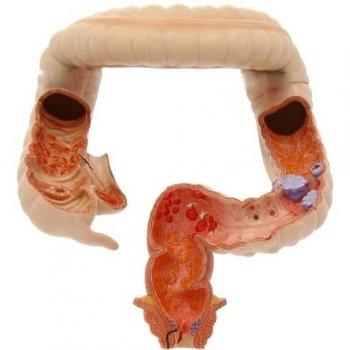 3B Scientific K55 Modelo de anatomía humana racto intestinal