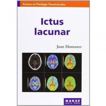 Ictus lacunar: 6