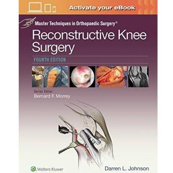 Master Techniques in Orthopaedic Surgery: Reconstructive Knee Surgery