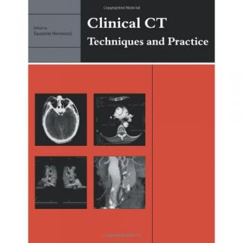 CT Clínico: Técnicas y Práctica - Cambridge