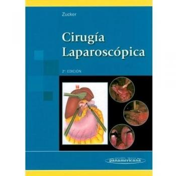 Cirugía Laparoscópica.