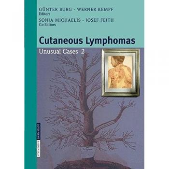 Cutaneous Lymphomas: Unusual Cases 2: v. 2