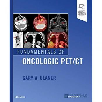 Fundamentals of Oncologic PET/CT, 1e