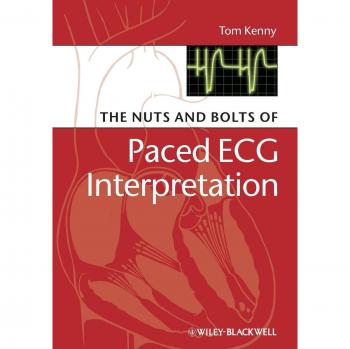 Paced ECG Interpretation Essentials by Tom Kenny
